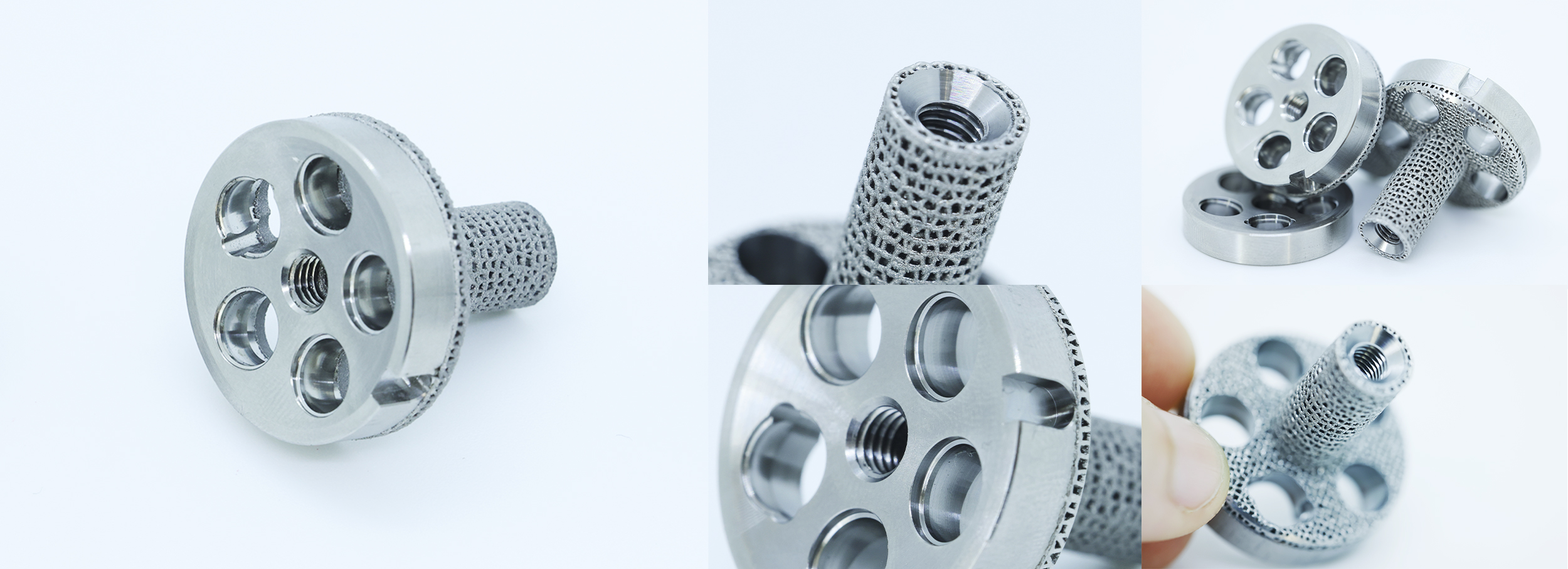Glenoid Impressions